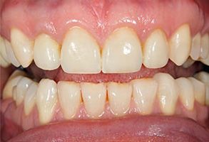 Southwest Dental Group | Periodontal Treatment, Ceramic Crowns and Orthodontics